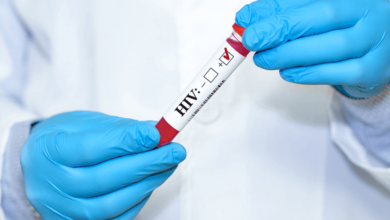 HIV Test at Home Dubai: A Convenient and Reliable Solution for Your Health